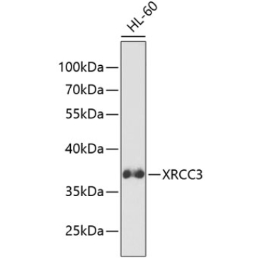 XRCC3 Rabbit Polyclonal Antibody