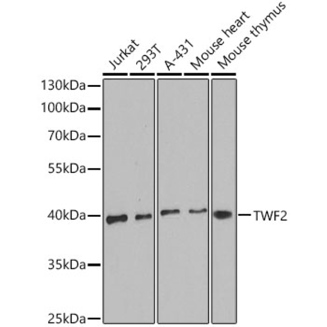 TWF2 Rabbit Polyclonal Antibody