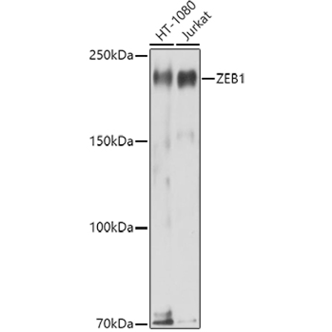 ZEB1 Rabbit Polyclonal Antibody