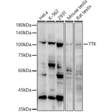 TTK Rabbit Polyclonal Antibody