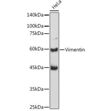 Vimentin Rabbit Polyclonal Antibody