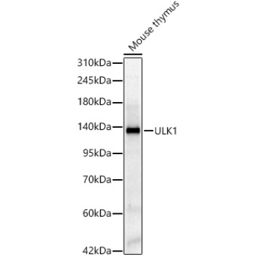 ULK1 Rabbit Polyclonal Antibody
