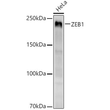 ZEB1 Rabbit Monoclonal Antibody