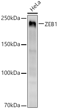 ZEB1 Rabbit Monoclonal Antibody