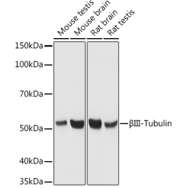 BetaIII-Tubulin Mouse Monoclonal Antibody