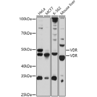 VDR Rabbit Polyclonal Antibody