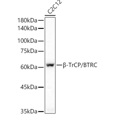 Beta-TrCP/BTRC Rabbit Monoclonal Antibody