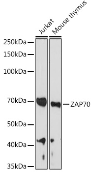 ZAP70 Rabbit Polyclonal Antibody