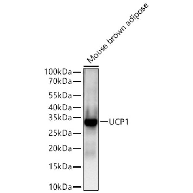 UCP1 Rabbit Monoclonal Antibody