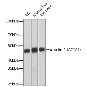 Alpha-Actin-1 (Alpha-SMA) Rabbit Monoclonal Antibody