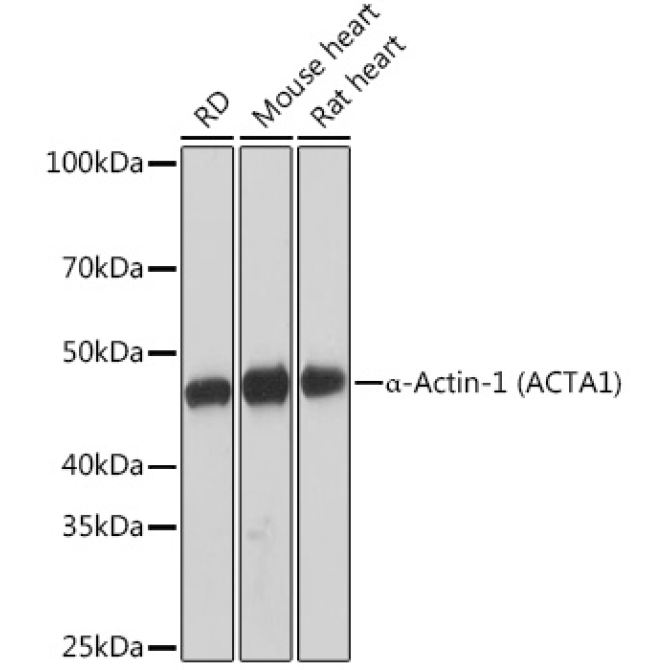 Alpha-Actin-1 (Alpha-SMA) Rabbit Monoclonal Antibody