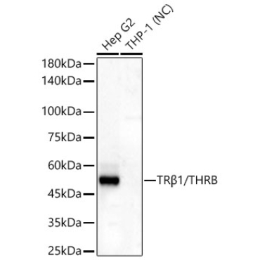 TRBeta1/THRB Rabbit Monoclonal Antibody