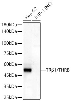 TRBeta1/THRB Rabbit Monoclonal Antibody