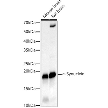 Alpha-Synuclein Rabbit PolyMonoclonal Antibody?