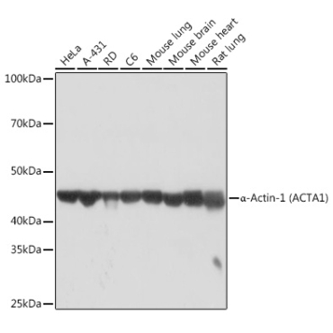 Alpha-Actin-1 (ACTA1) Rabbit Monoclonal Antibody