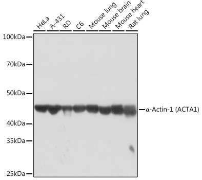 Alpha-Actin-1 (ACTA1) Rabbit Monoclonal Antibody