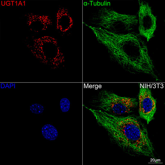 UGT1A1 Rabbit Monoclonal Antibody
