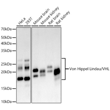 Von Hippel Lindau/VHL Rabbit Monoclonal Antibody