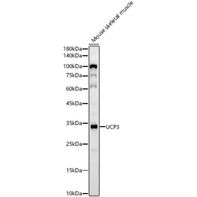 UCP3 Rabbit Monoclonal Antibody