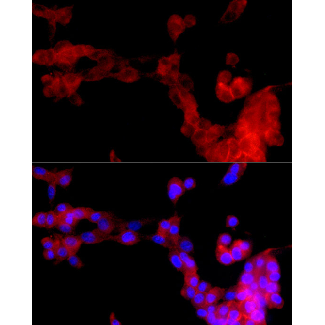 uPAR/U-PAR Rabbit Monoclonal Antibody