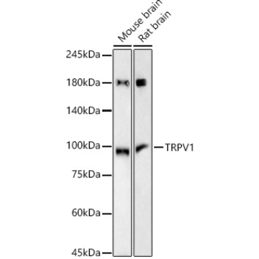 TRPV1 Rabbit Monoclonal Antibody
