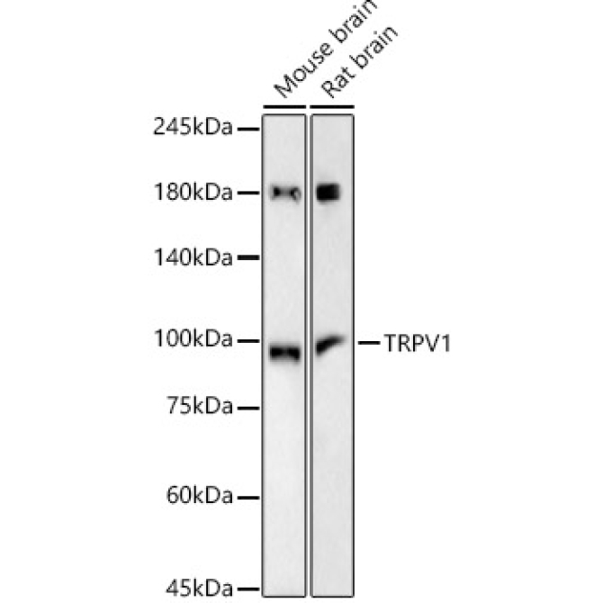 TRPV1 Rabbit Monoclonal Antibody
