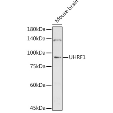 UHRF1 Rabbit Polyclonal Antibody