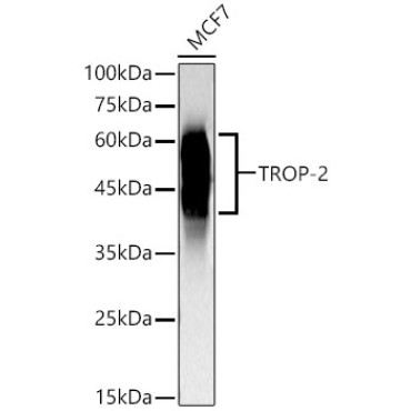 TROP-2 Rabbit Monoclonal Antibody
