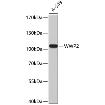 WWP2 Rabbit Polyclonal Antibody