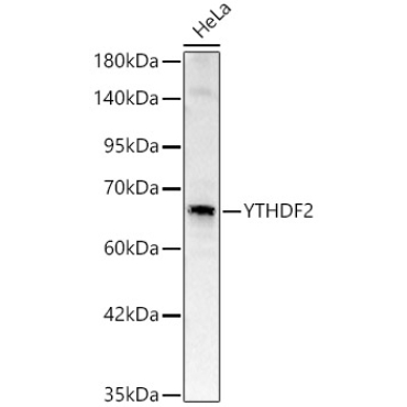 YTHDF2 Rabbit Polyclonal Antibody