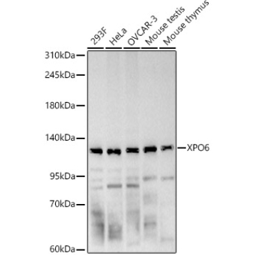 XPO6 Rabbit Polyclonal Antibody