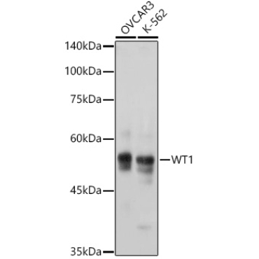 WT1 Rabbit Monoclonal Antibody