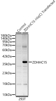 ZDHHC15 Rabbit Polyclonal Antibody
