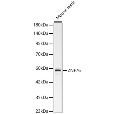 ZNF76 Rabbit Polyclonal Antibody