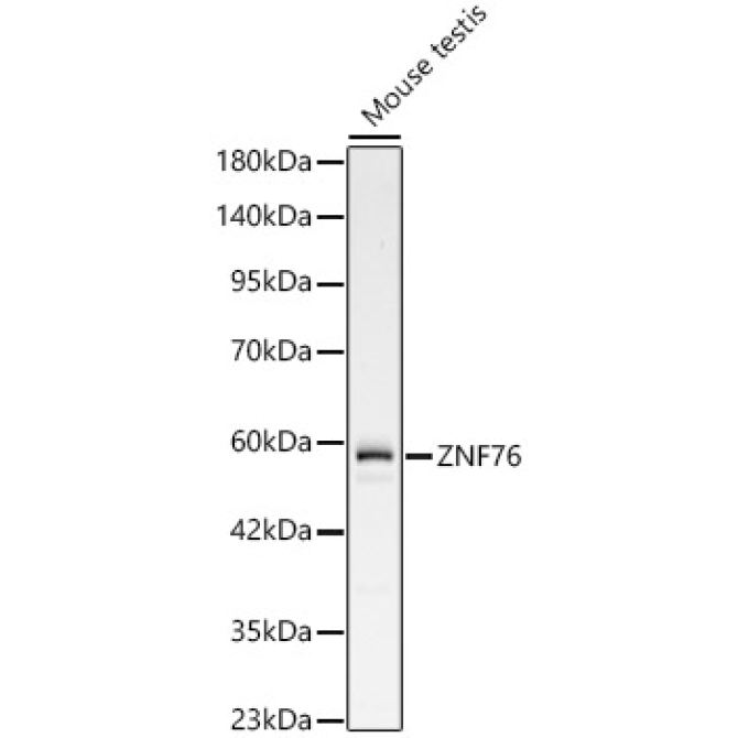 ZNF76 Rabbit Polyclonal Antibody