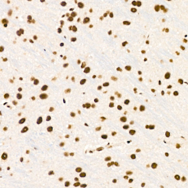 ZNF324 Rabbit Polyclonal Antibody
