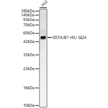 VISTA / B7-H5 / GI24 Rabbit Polyclonal Antibody
