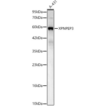 XPNPEP3 Rabbit Polyclonal Antibody
