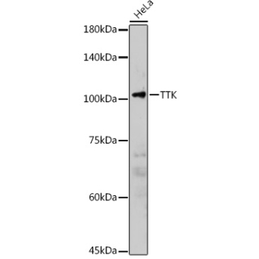 TTK Rabbit Polyclonal Antibody