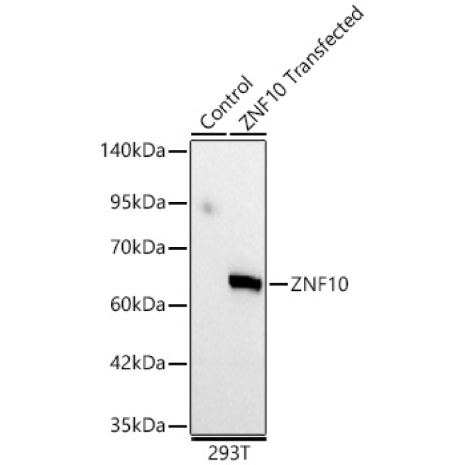 ZNF10 Rabbit Polyclonal Antibody