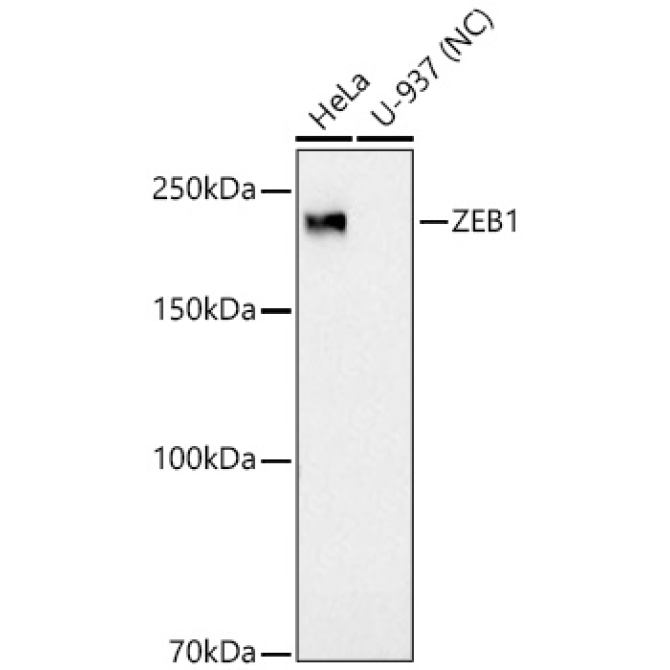 ZEB1 Rabbit Monoclonal Antibody