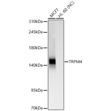 TRPM4 Rabbit Monoclonal Antibody