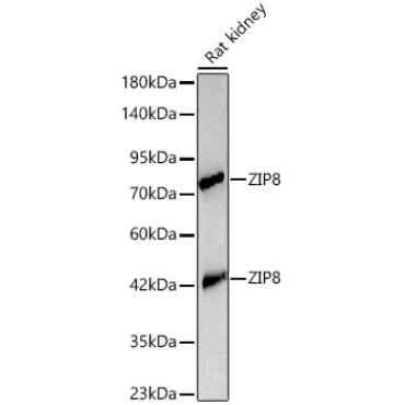 ZIP8 Rabbit Polyclonal Antibody