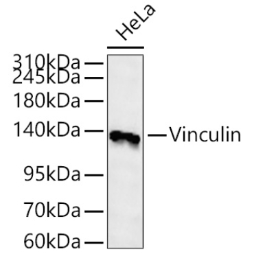 Vinculin Rabbit Polyclonal Antibody