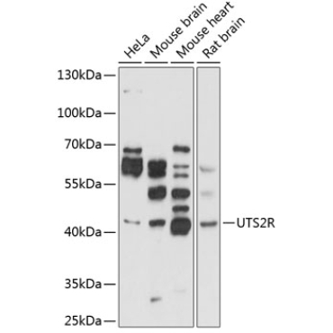 UTS2R Rabbit Polyclonal Antibody