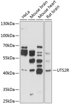 UTS2R Rabbit Polyclonal Antibody