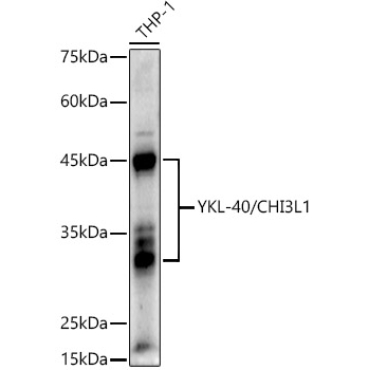 YKL-40/CHI3L1 Rabbit Polyclonal Antibody