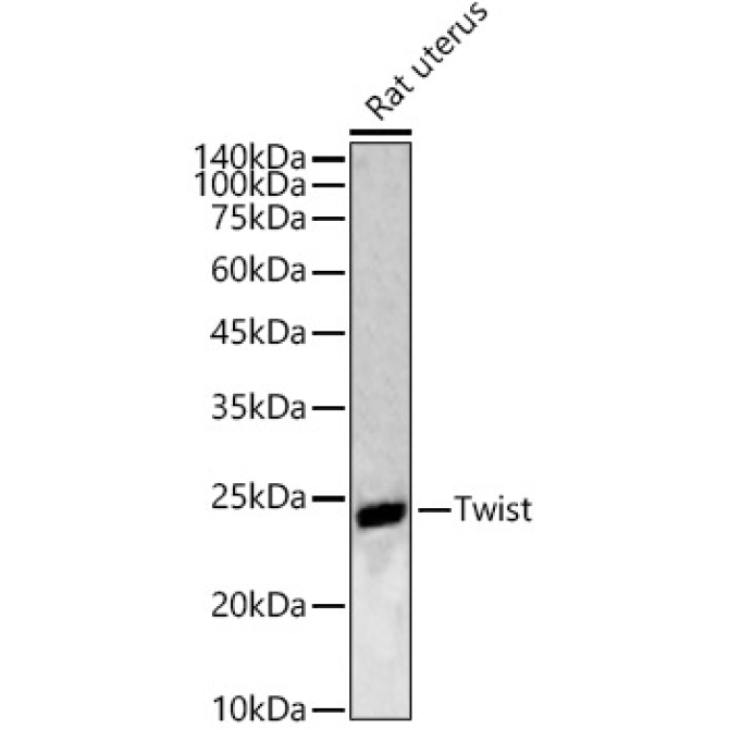 Twist Rabbit Polyclonal Antibody