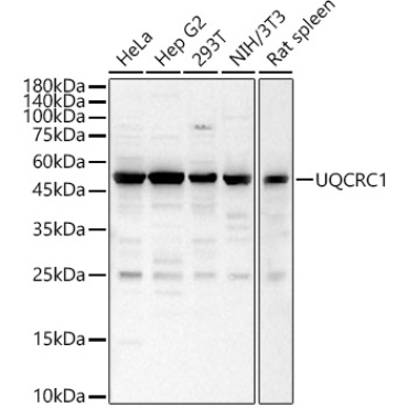 UQCRC1 Rabbit Polyclonal Antibody