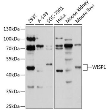 WISP1 Rabbit Polyclonal Antibody